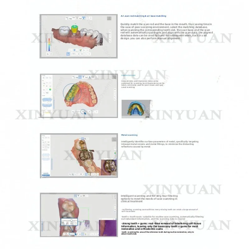 Intraoral Scanner i500, Lightning Fast Device with Excellent Patient Comfort and Smooth Open Architecture Digital Workflow