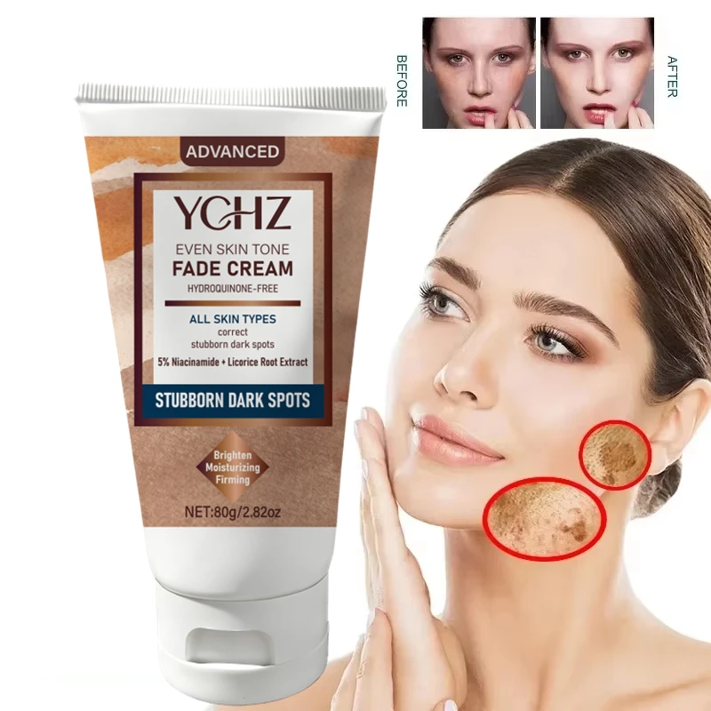 Advanced Anti-Fading Cream, Pigmentation Treatment, Stubborn Dark Spot Repair Agent, Results in 2-3 Weeks, Niacinamide, Evens Skin Tone, Eliminates Dark Spots and Dullness - Non-Greasy, Suitable for Both Men and Women - Whitening and Moisturizing Cream, for Day and Night Use