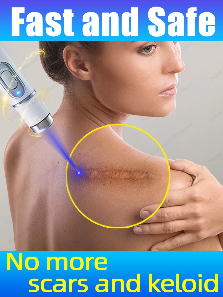 Laser scar repair