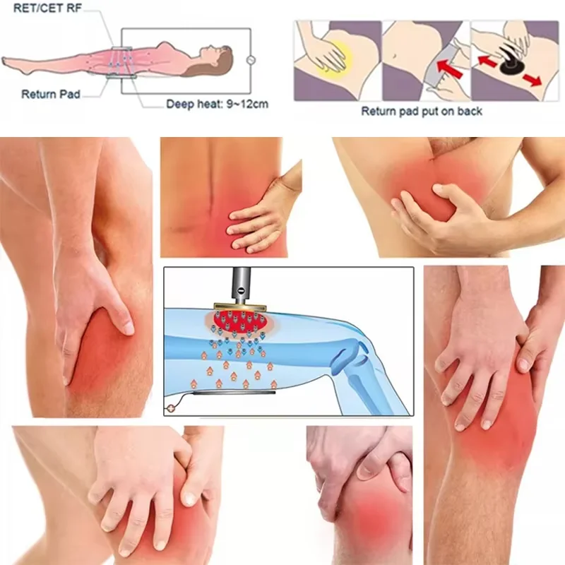 Заводская емкостная резистивная диатермия тела Tecarterapia Tecar Therapy Cet Ret диатермия обезболивающая физиотерапевтическая машина