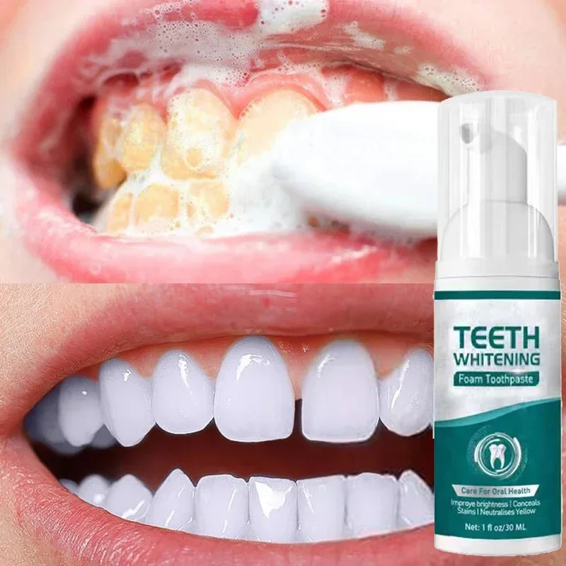 V34 Teeth Whitening Oral Hygiene Tooth Care Products Remove Plaque Tooth Stain Gingival Repair Caries Prevention Oral Cleaning