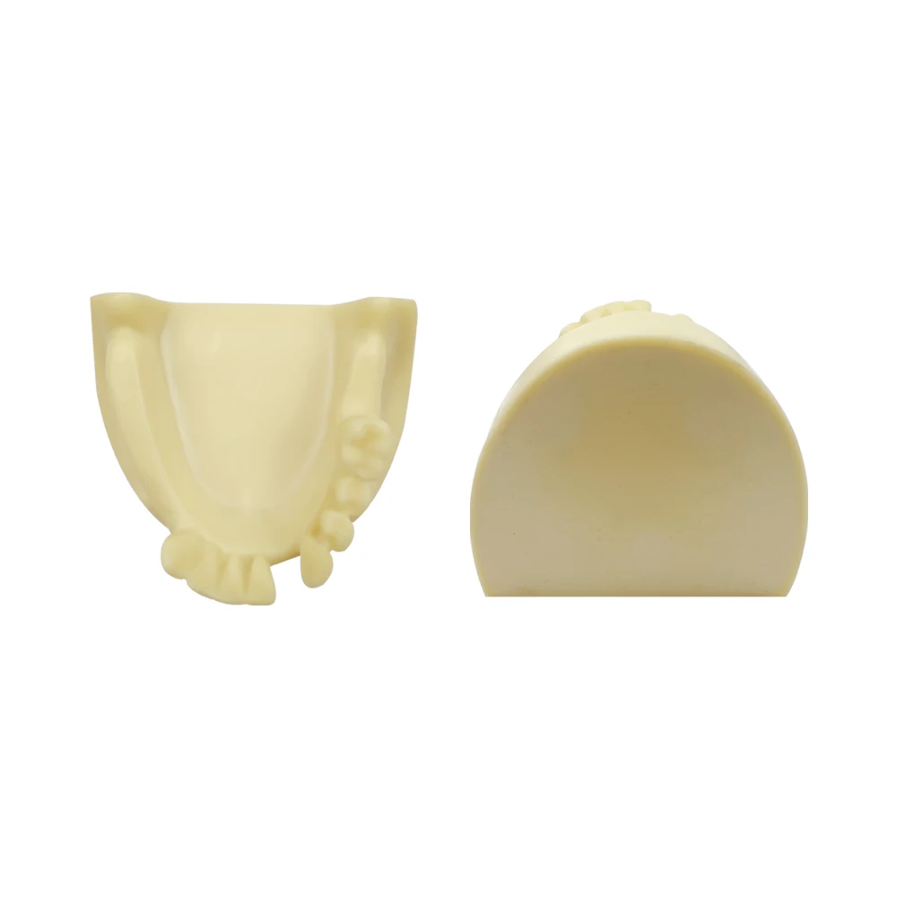 Dental Maxillary Implant Model Mandibular Tooth Missing Implant Practice Model for Dentist Technician Teaching Training 