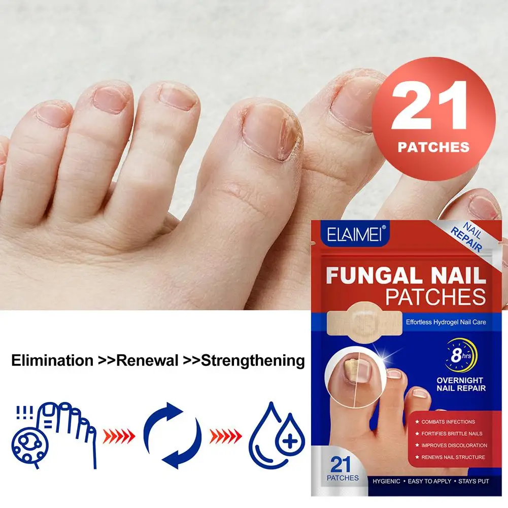 21Pcs/Set Foot Nail Repair Patch Grey Fungal Nail Thicken Soft Paronychia Infection Hand Nail Correction Sticker Ingrown Toenail