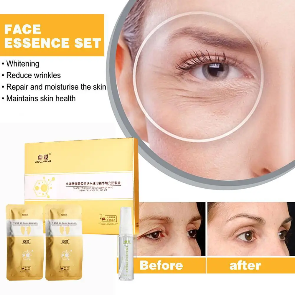 Collageen Essence Vulset Voor Vrouwen Spiraalvormig Peptide Hert Bot Collageen Essence Kit Japanse Lifting Gezichtsserum Anti-Aging