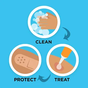 Plester Perekat Bantalan Bersirkulasi Tahan Air Plester Perekat Luka Stiker Hemostasis Pita Perban Pertolongan Pertama Kasa Medis 8 penjualan terbaik ipad air 1 - №