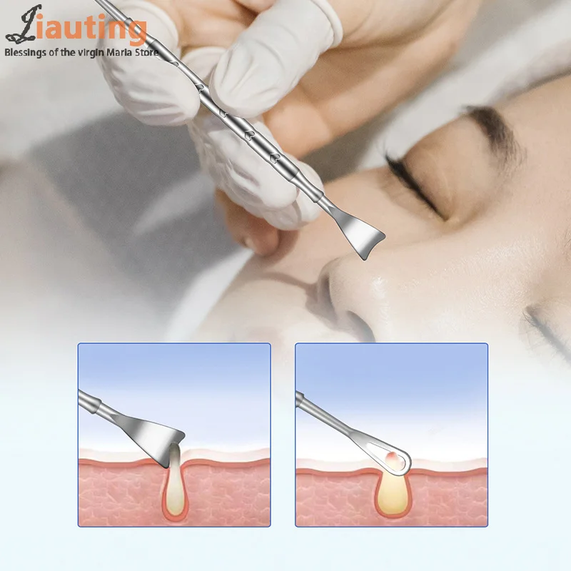 Blackhead Remover สิว Popper เครื่องมือเข็มสิวถอด Treatment Whitehead Popping Zit จมูก Face Blemish EXTRACTOR Cleanser