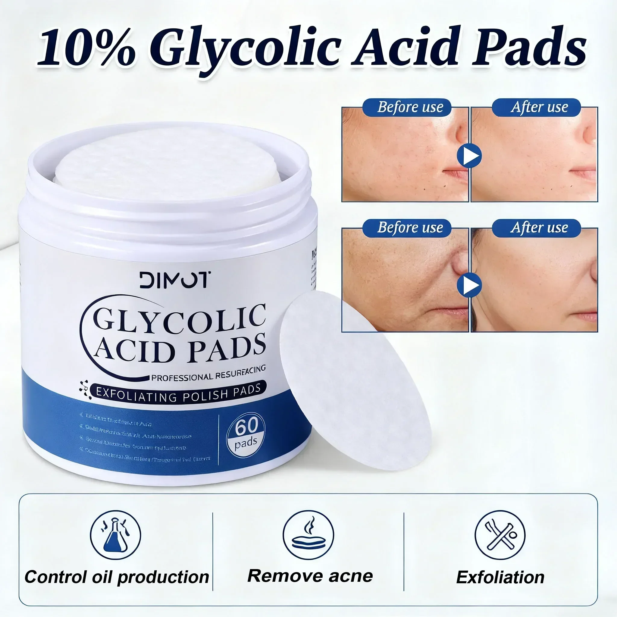 

Pore Purifying Glycolic Acid Pads (60pcs) - 10% Strength for Acne & Oil Control, Gently Exfoliates & Hydrates Skin.