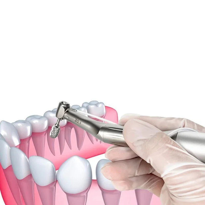 NEUE Dental Implantat GBR Knochen Konturierung Bohrer Knochen Gestaltung Cutter Stahl Keramik Bohrer Sinus Lift Bohrer Dental Implantat Werkzeug
