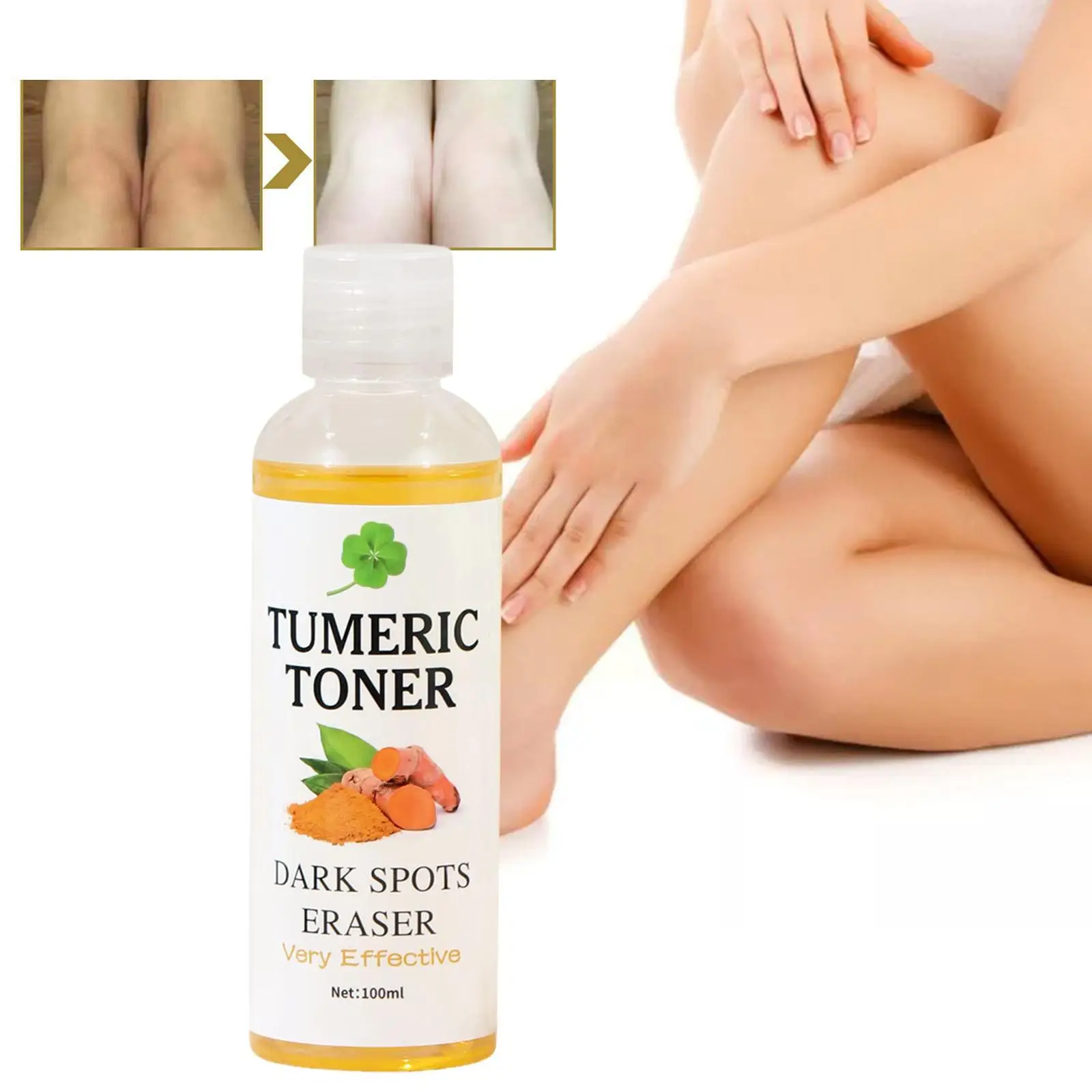 100ml Kurkuma dunkle Flecken Toner Radiergummi Korrektor Kurkuma Entferner Akne aufhellen dunklen Entferner feuchtigkeit spendende Flecken Toner e8a4