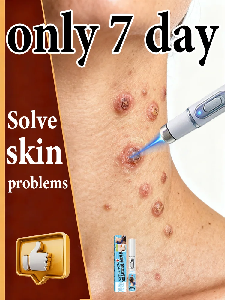 

Gᴇɴᴇʀᴀᴛɪᴏɴ-3 Lᴀsᴇʀ Sᴀʏs Gᴏᴏᴅʙʏᴇ Tᴏ Wᴀʀᴛs Iɴ 7 Dᴀʏs