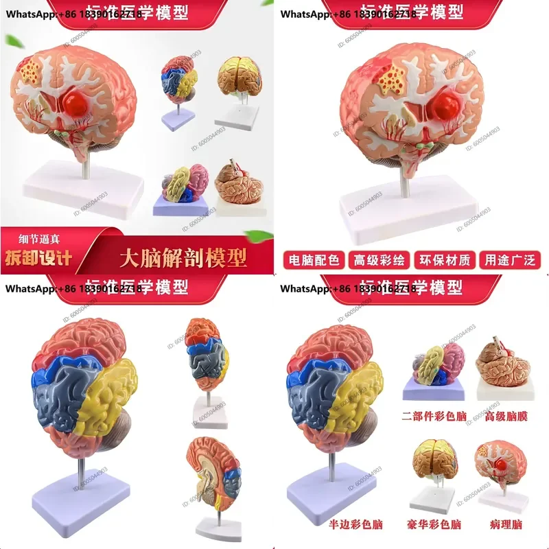Human Brain Anatomy Model Splitable Structure Hierarchy Module for Hospital School Teaching Demonstration