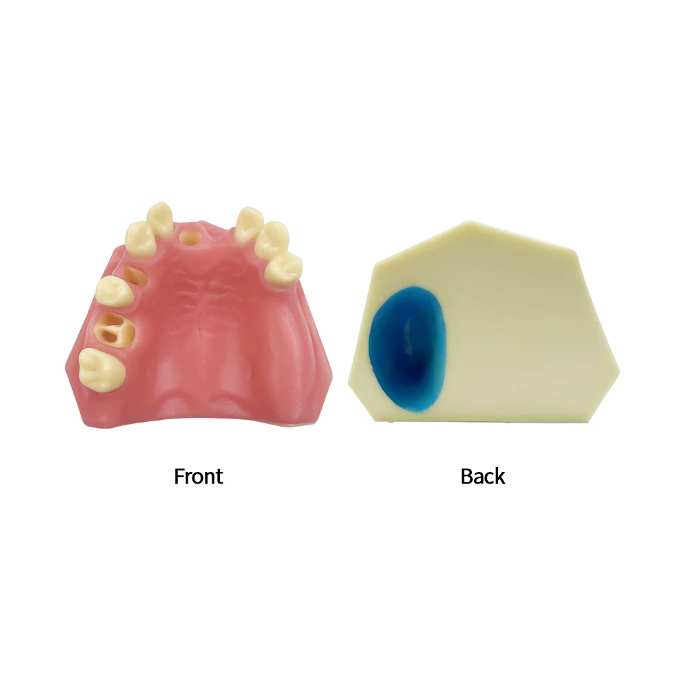 Dental Maxillary Implant Practice Model With Missing Teeth Teaching Model for Dentist Tooth Dentist Demonstration Tool Dentistry