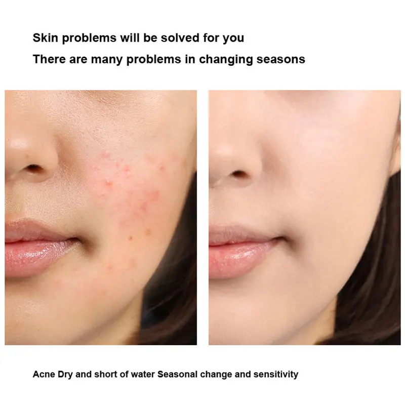 알로에 베라 글루 수면 마스크, 모공 수축, 오일 컨트롤, 부드럽고 부드러운 보충, 미세 라인 마스크 크림, 10 개