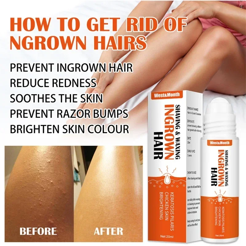 20ml Ingrown Hair After Shave Repair Shaving Waxing Serum Treatment Prevent Razor Bumps Soothes Redness Soothes Skin Care Beauty