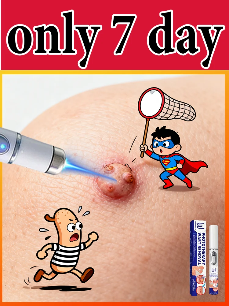 

Gᴇɴᴇʀᴀᴛɪᴏɴ-3 Lᴀsᴇʀ Sᴀʏs Gᴏᴏᴅʙʏᴇ Tᴏ Wᴀʀᴛs Iɴ 7 Dᴀʏs