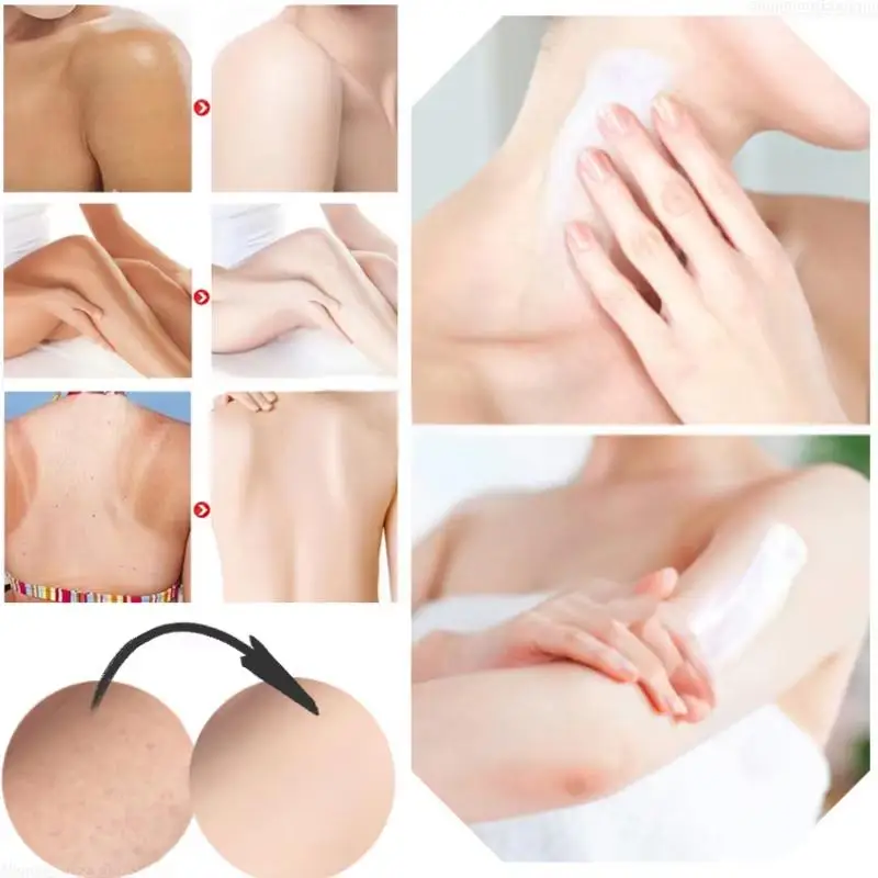 كريم تفتيح الجسم أجزاء خاصة تحت الإبط مصل تبييض بعقب الركبة الرقبة تفتيح الفخذ الداخلي الأجزاء الحميمة العناية بالبشرة الداكنة