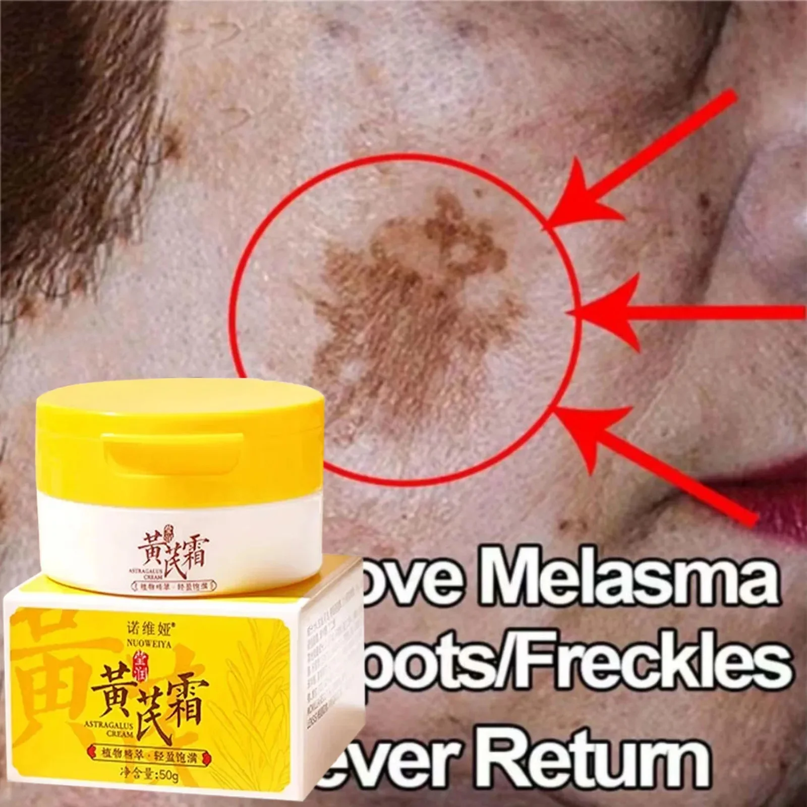 Astragalus Whitening Freckles Cream Face Dark Spots Remover Repair Products Removal Melasma Melanin Moisturiz Nourish Skin Care