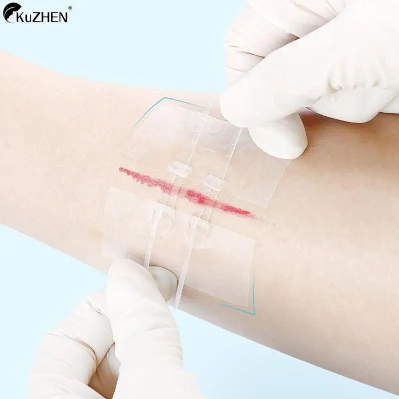 1/2Pcs Zipper Tie Wound Closure Patch Hemostatic Patch Wound Fast Suture Zipper Band-Aid Outdoor Portable