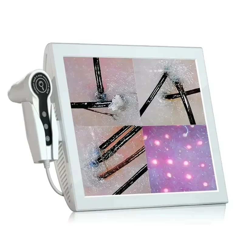Display HD da 2025/-15 pollici Rilevatore professionale di follicoli piliferi Macchina diagnostica per il cuoio capelluto Analizzatore della pelle Tester per l'umidità dell'olio