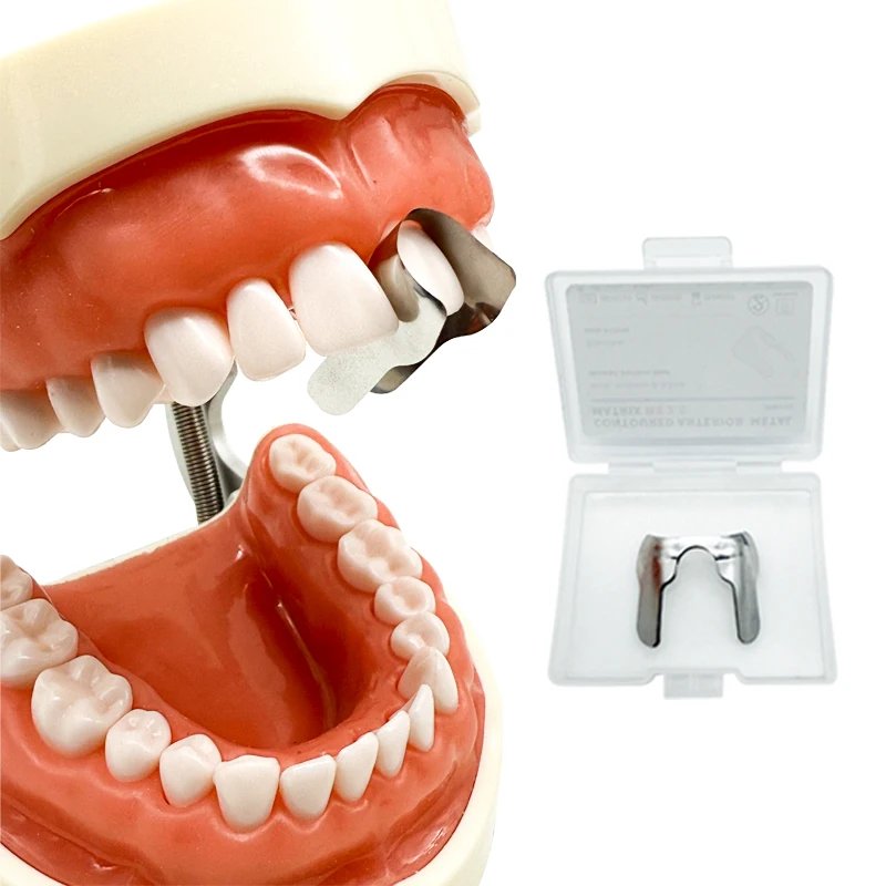 30 PCs/box Dental Matrix Anterior Teeth M8 2.0 Long/short Matrix System Anterior Teeth Restoration Material Tool