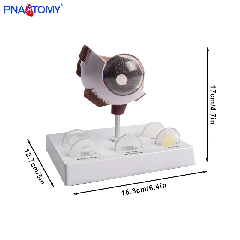 Pathological Eye Model Eye Model Corneal Disease Eye Model