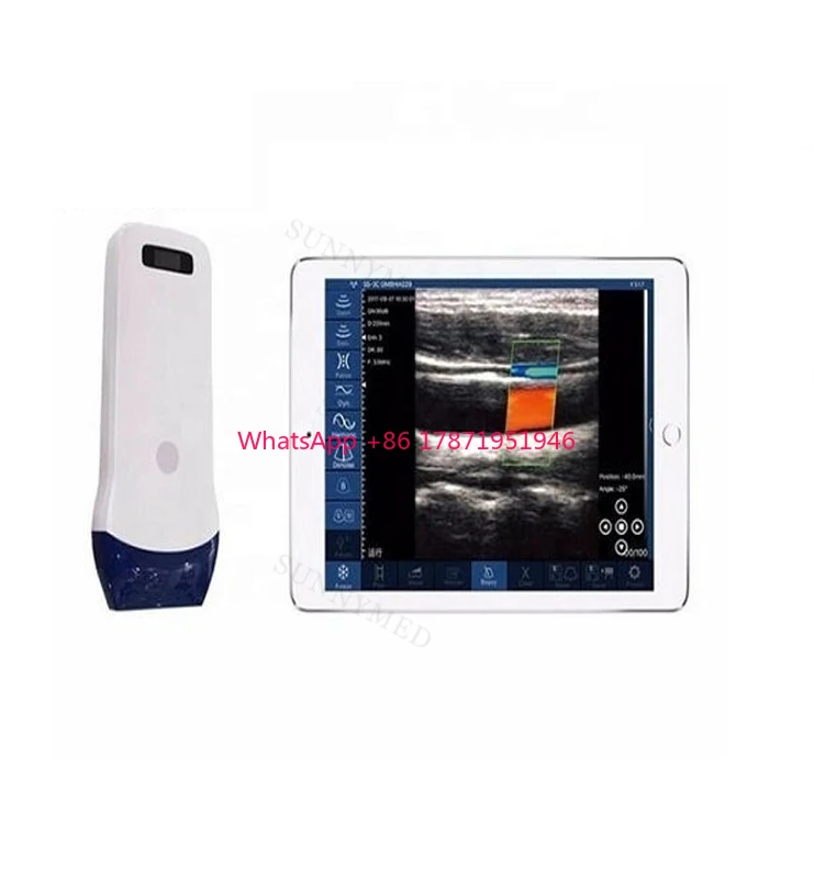 

SY-5L Portable Medical Color Doppler Probe Pocket Wireless Wi-Fi Ultrasound Machine wireless ultrasound scanner