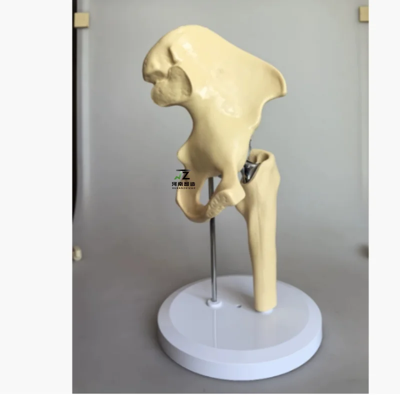 Artificial Hip Joint Model High Quality Medical Teaching Model Material: PVC ABS Plastic Electroplated Parts