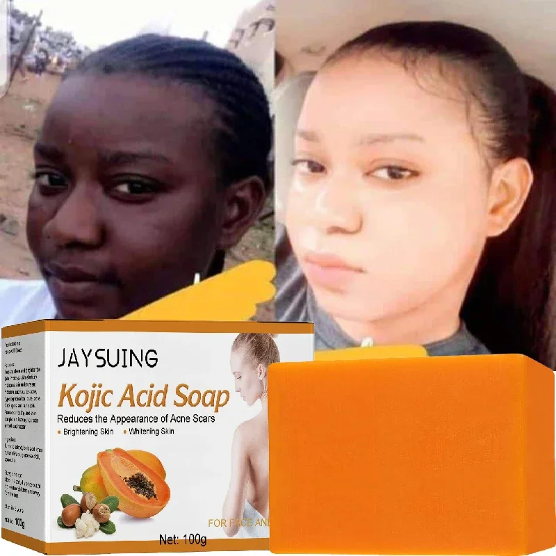 

100g Soap Body Wash with Natural Botanical Ingredients Eliminates Dark Spots Lightens Reduces Scars Cleanses and Emollients