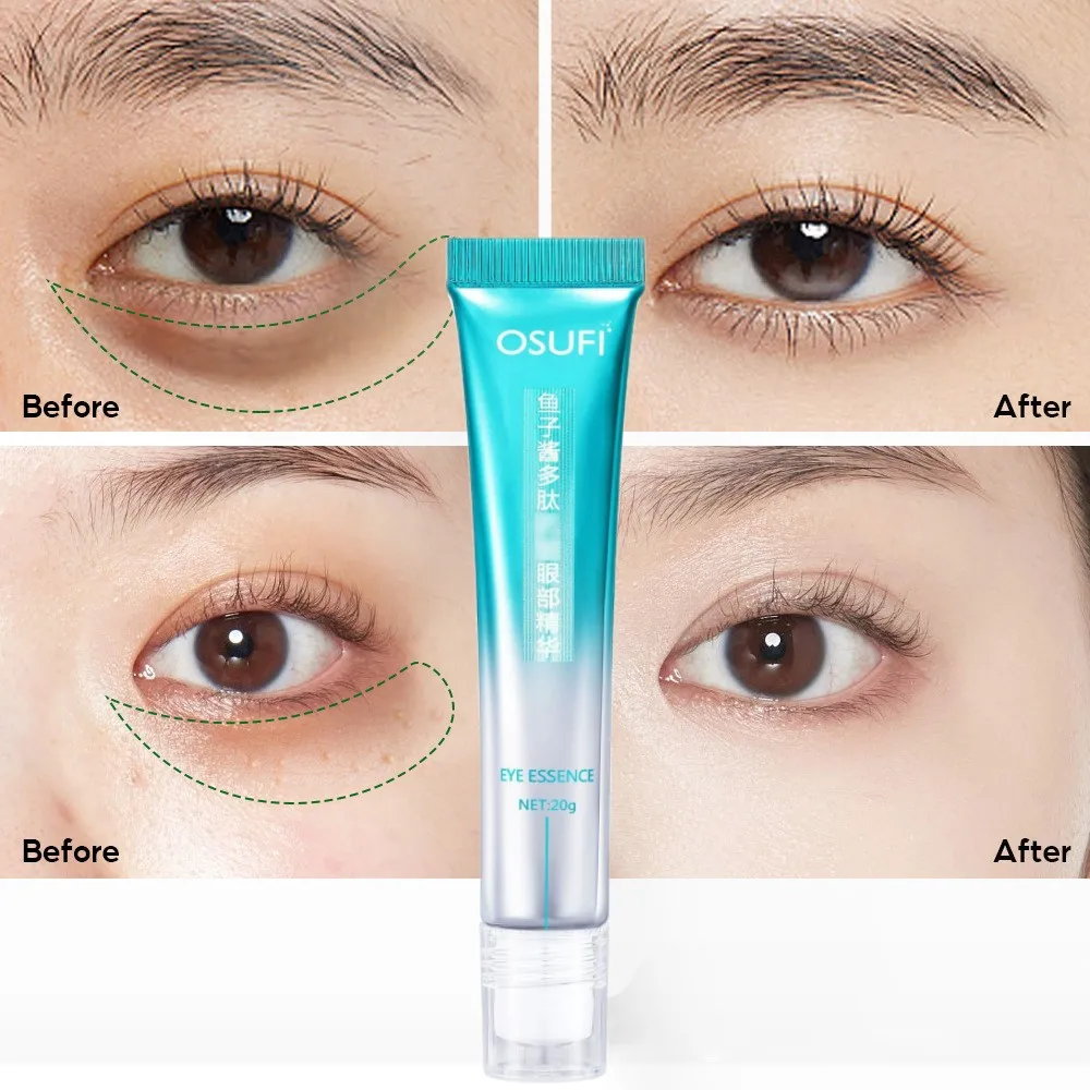 New Anti Wrinkle Eye Essence Reduces Eye Wrinkles Removes Eye Bags Dark Circles Moisturizes Skin Around Eyes Massage Eye Cream