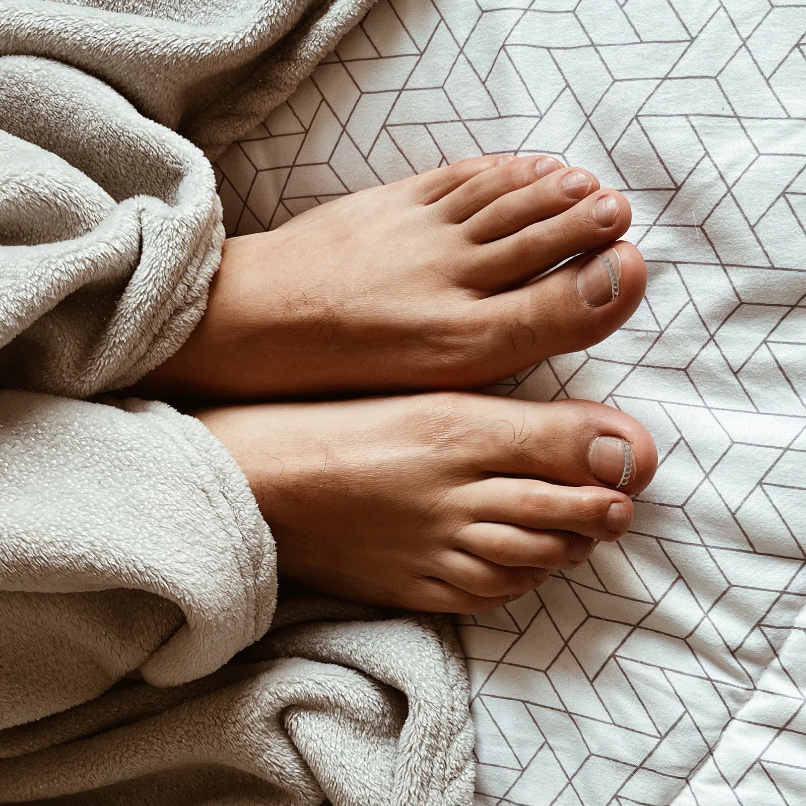 

12pcs Stainless Steel Toenail Corrector Reusable Nail Correction Wire For Ingrown Toenail Relief Compact Durable Foot Care Tool