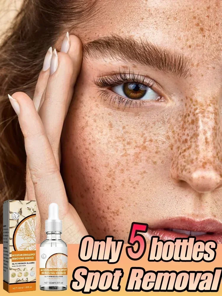 

Dark Spots Remover Serum Powerful Removal Black Dot Melasma Chloasma Niacinamide Whitening Moisture Freckle Face Skin Care