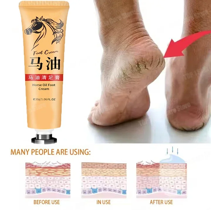 Anti Crack Foot Cream Drynes Foot Mask Heel Cracked Repair Cream Hand Mositurizing Removal Callus Dead Skin Hands Feet Care