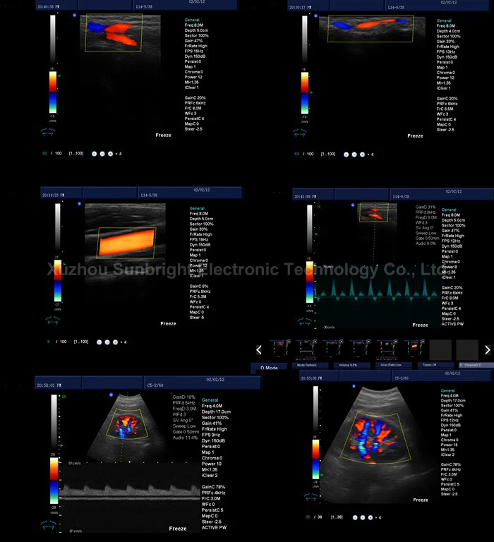 Digital color Doppler system 3D 4D trolley 4 probe connectors 19