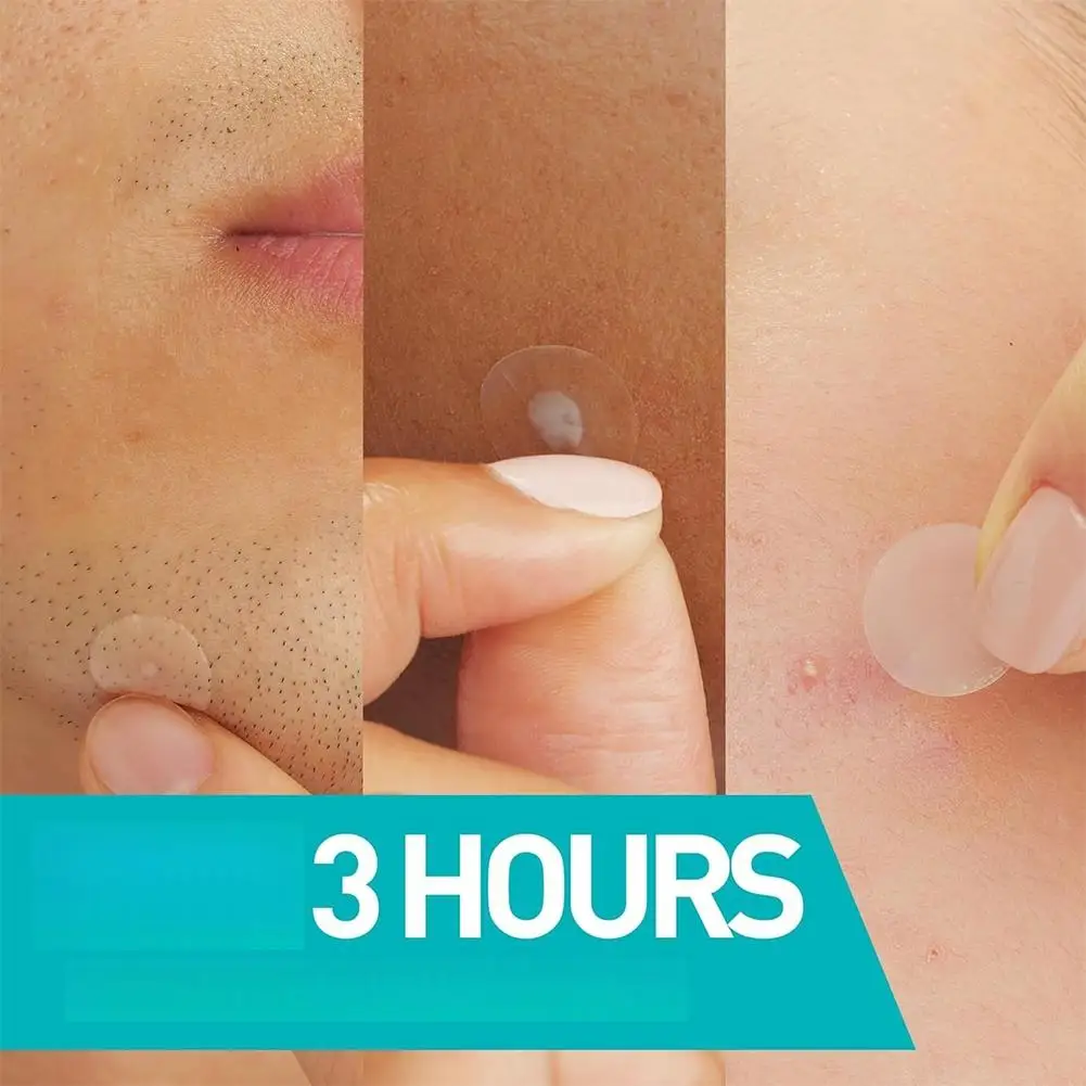 24/200/800 unidades de Adesivos para Acne, Adesivos de Cuidados com a Pele, Transparentes Circulares, para Cobertura de Manchas Faciais, Ferramentas d