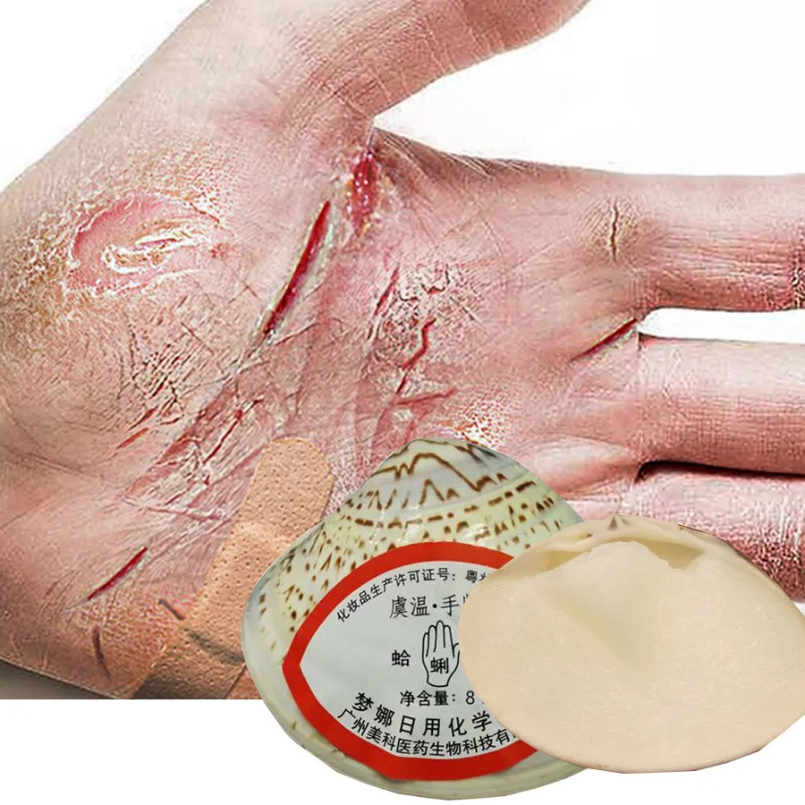 New Traditional Chinese Clam Oil Anti-Dry Crack Foot Repair Cream Removal Dead Skin Callus Soften Hand Heel Moisturize Care Mask