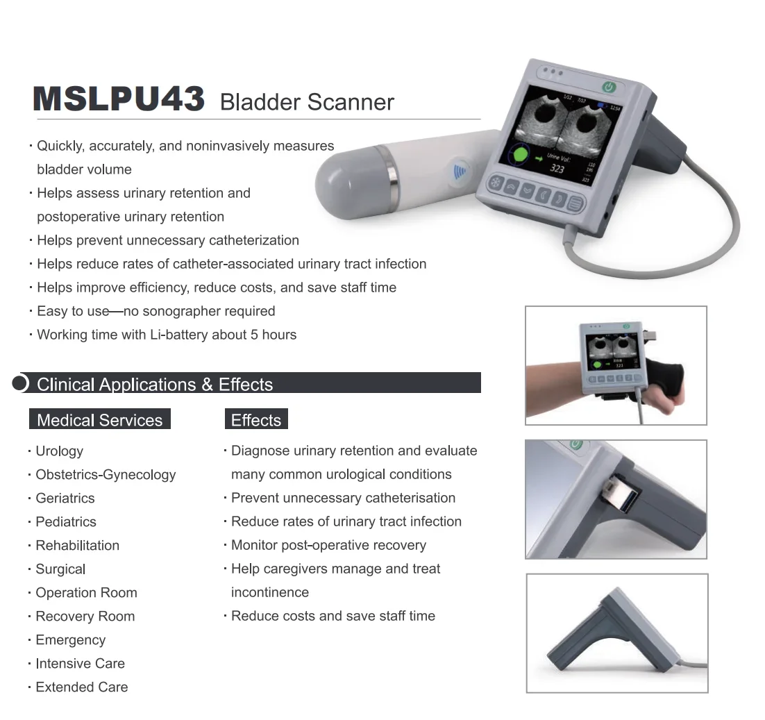 ماسح ضوئي لحجم المثانة المحمول - جهاز الموجات فوق الصوتية المحمول