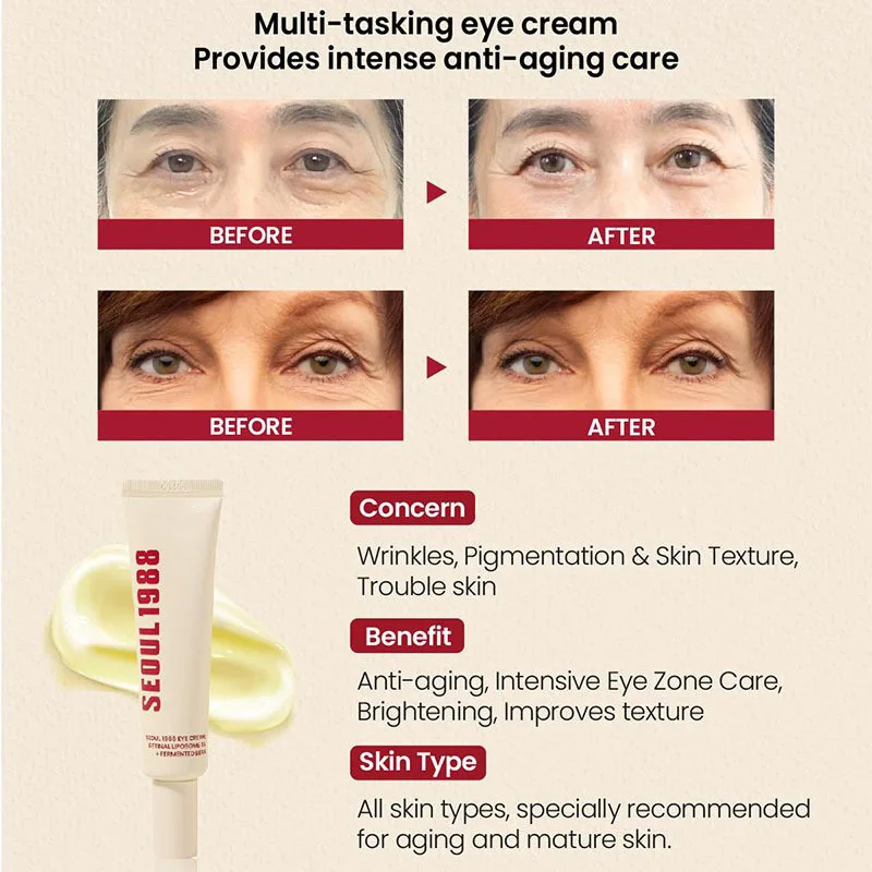 كريم سيول 1988 للعين، مصل الريتينول، مضاد للتجاعيد، مضاد للشيخوخة، مرونة البشرة، التصبغ، النياسيناميد، العناية بالبشرة الكورية