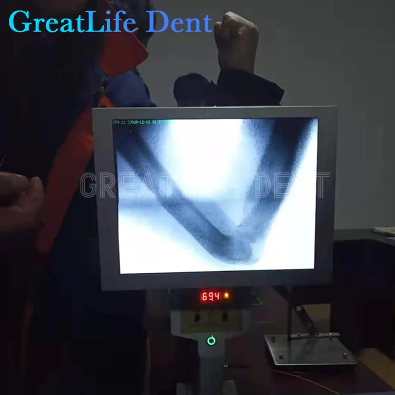 GreatLife Dent Medical Portable X-ray Machine Orthopedic Fluoroscopy Detection Veterinary Pets Dog X Ray Camera Sensor Scanner