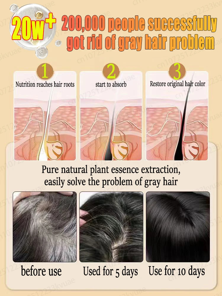 White hair killer, remove gray hair and restore natural hair color in 7 days