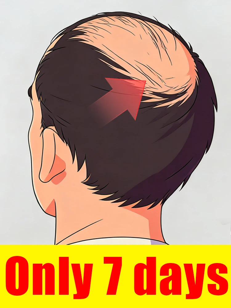 

Don't let your hands feel empty when you touch your head,A head full of hair in 7 days