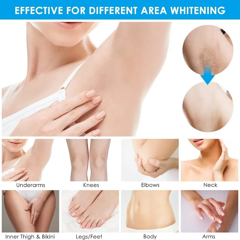 Whitening Cream for Dark Underarm Knees Elbows Inner Thigh Bikini Line Armpit Area Bleaching Cream Spot Remover Body Black Skin