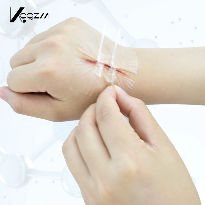 

10 Buckles Zipper Tie Wound Closure Patch Hemostatic Patch Wound Fast Suture Zipper Band-Aid Outdoor Portable