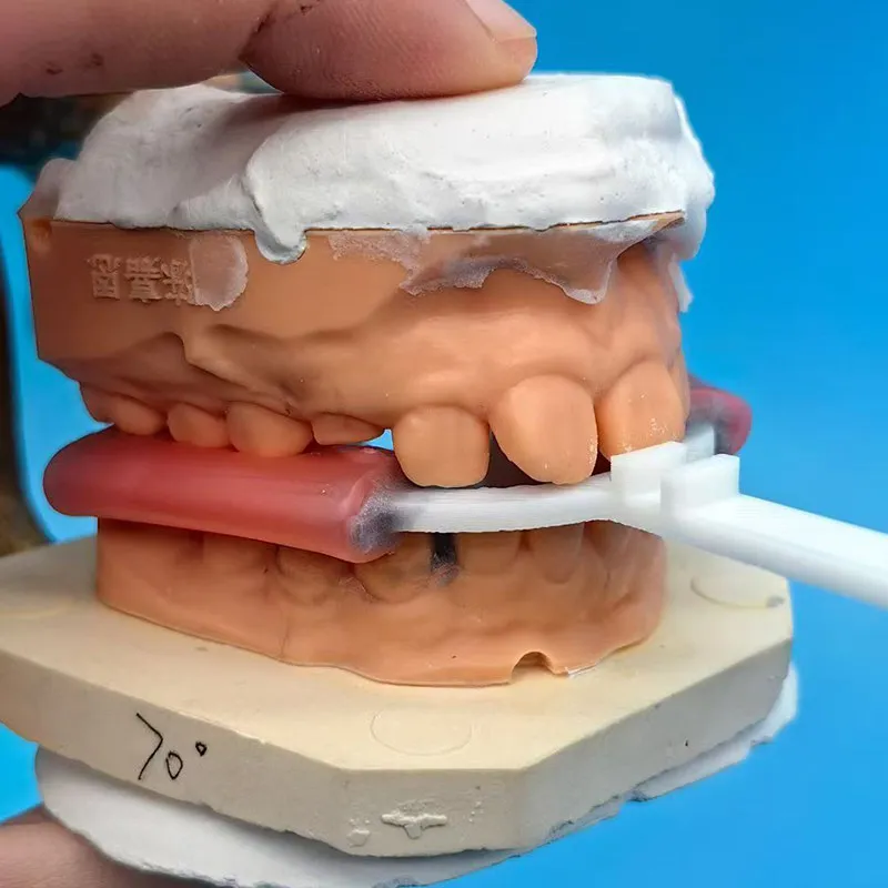 Horquilla de mordida mandibular para ortodoncia dental, Horquilla de mordida TB, Horquilla de mordida activadora muscular, Horquilla de mordida prefabricada Exacto