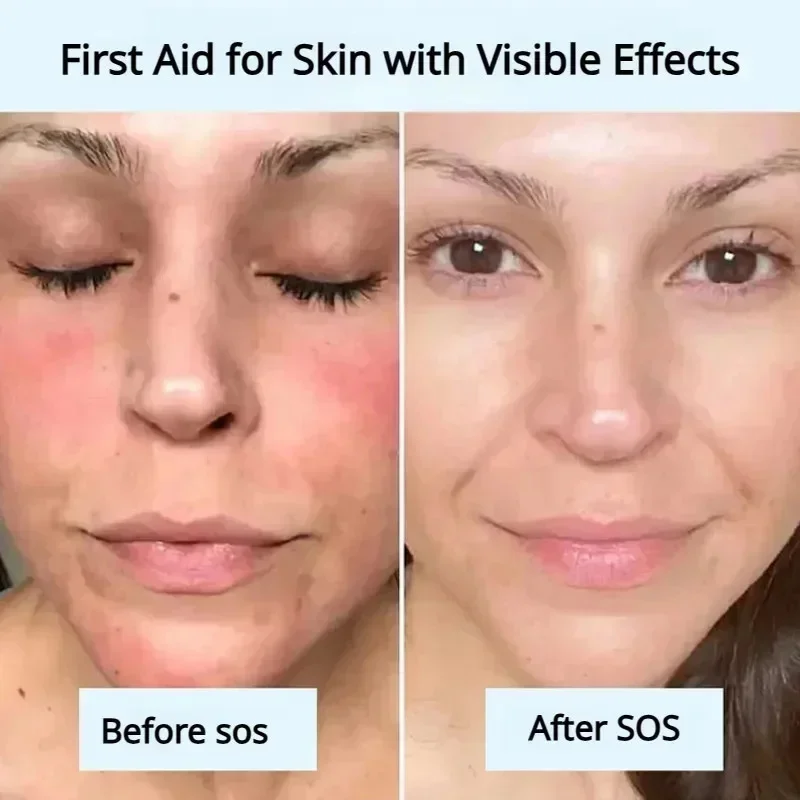 Máscara profunda real de bio-colágeno, Anti-rugas, Máscara Facial de Levantamento com Colágeno Hidrolisado, Filme Reverso, Volume Peel Off Mask