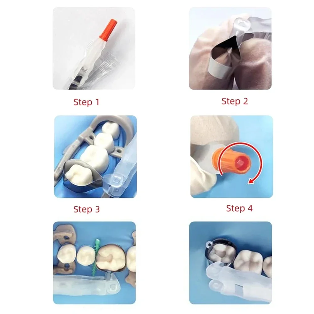 Sistema de matriz dental, rodillo de matriz contorneado seccional, retenedor de bandas de matriz 180 °   Materiales ajustables para coronas dentales