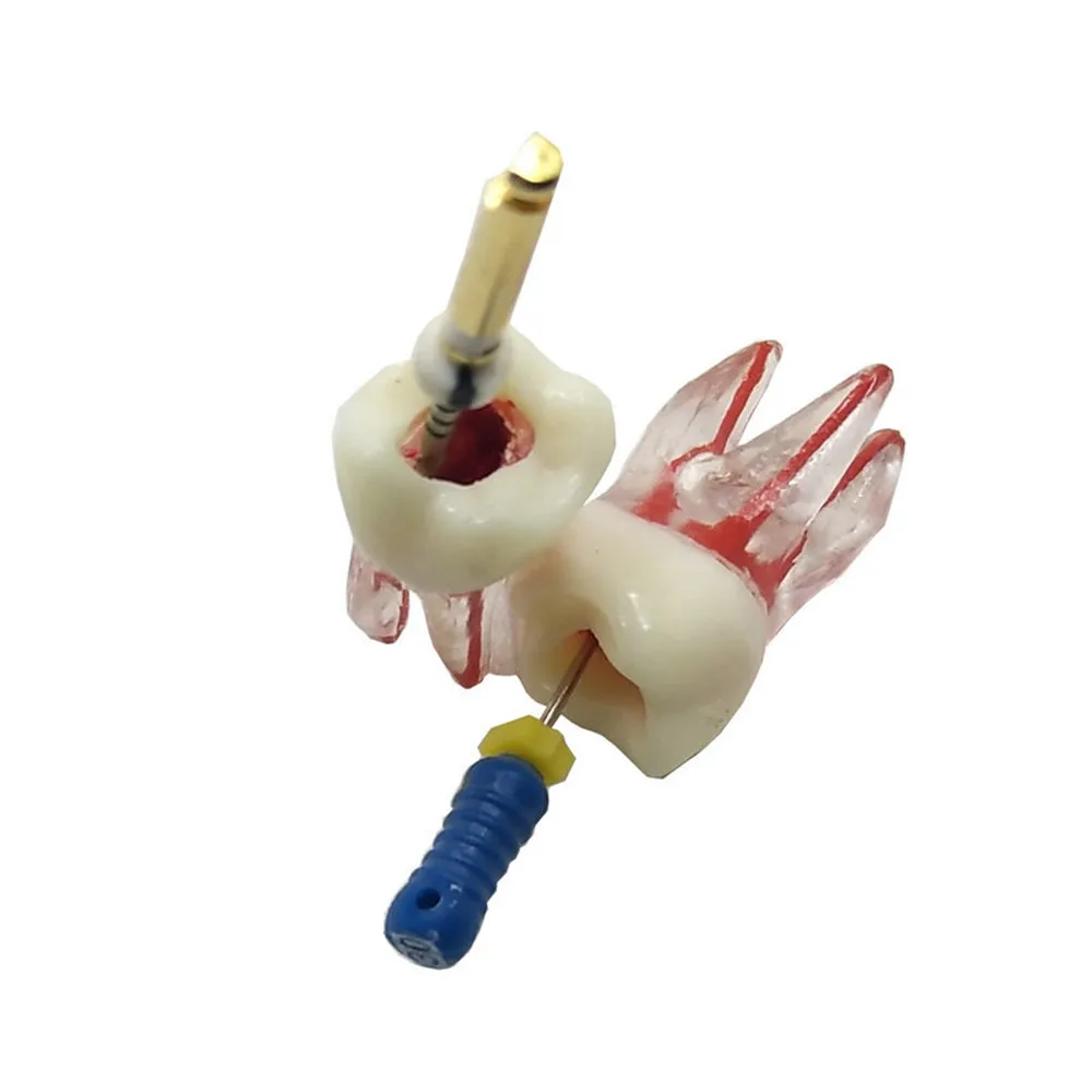 1pc Dental Model Endodontic Root Canal Block Practice Teeth Pulp Cavity Tooth Model Dentistry Replace Teeth Training Products