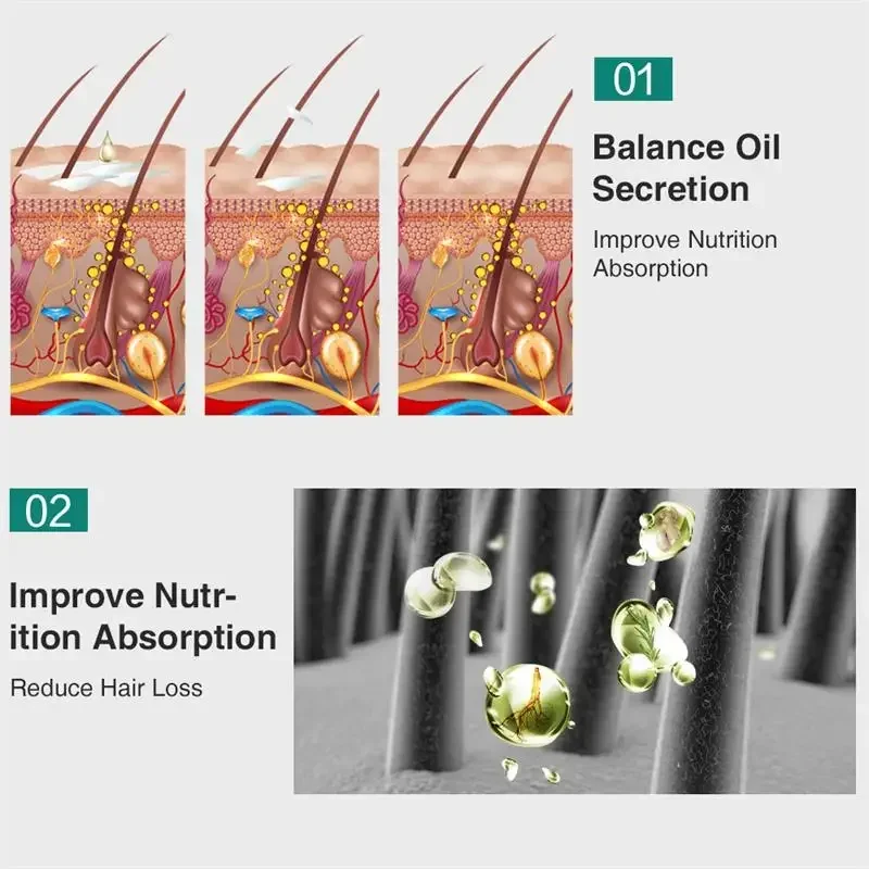 7 Days Fast Grow Hair Growth Serum Oil Dense Regrowth Ginger Hair Care Repair Liquid Essential Anti Loss Hair Oil 10/20/40ml view 5