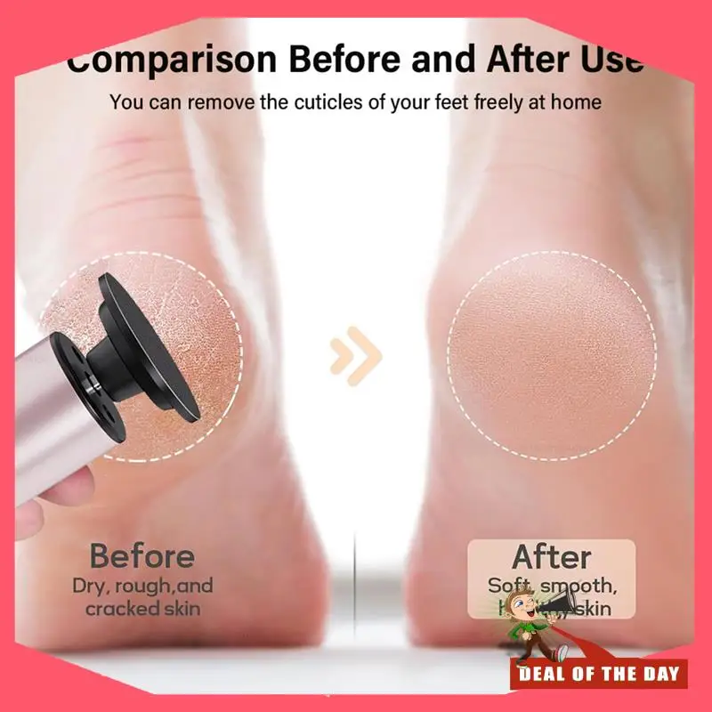 24-Hour Delivery For Feet Callus Removal Electric Foot Grinder Remover Sander File Pedicure Machine For Feet Exfoliator