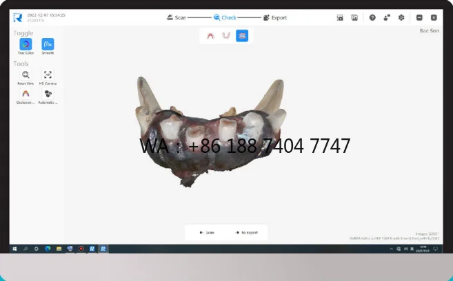 Veterinary Oral Scanner Cloud Sharing Reliable 3D True Color Accurate Digital Model Taking Intraoral Scanner