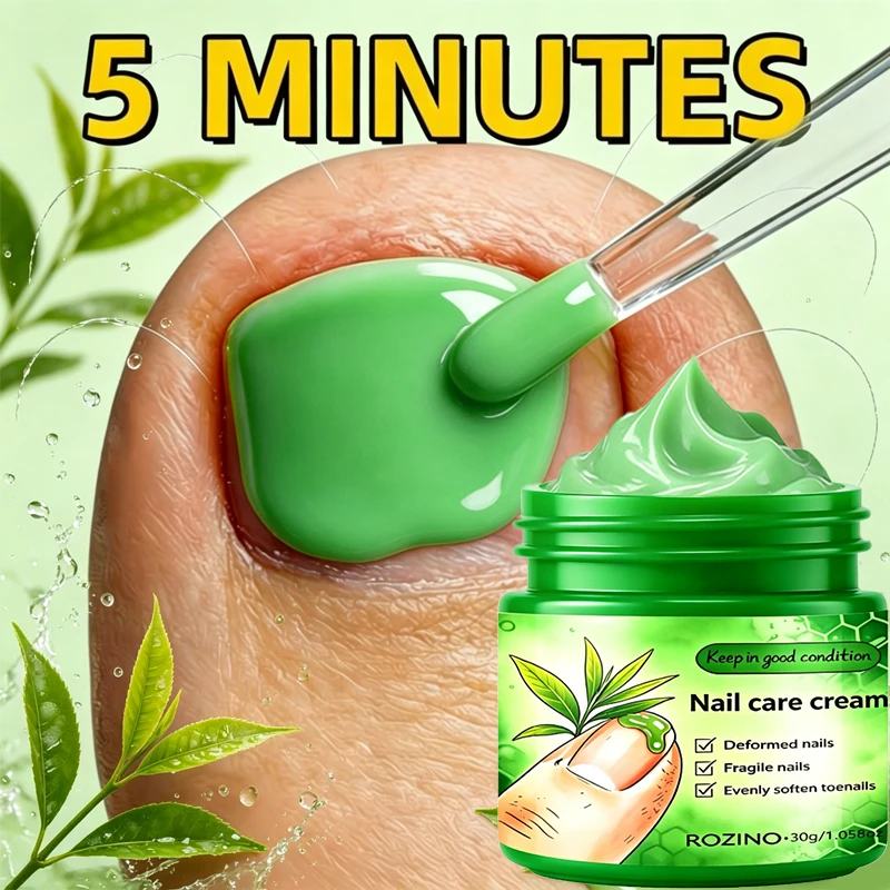 1Pcs/2Pcs/3Pcs Tea Tree Nail Care Cream, Provides 24-Hour Continuous Care for Nails, Moisturizes, Brightens Nails, Improves Signs of Nail Cracking/Splitting, Dullness, Roughness, and Unevenness, Suitable for Worn, Chipped, Broken, Fragile, Split Ends, and Uneven Nails, and Keeps Nails in Good Condition